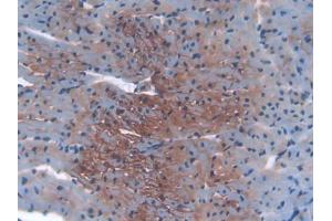DAB staining on IHC-P; Samples: Mouse Heart Tissue (IGF2R Antikörper  (AA 1148-1365))