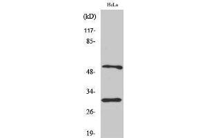 Western Blotting (WB) image for anti-Caspase 10 B/C (C-Term) antibody (ABIN3174181) (Caspase 10 B/C (C-Term) Antikörper)