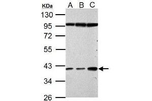 WB Image Haptoglobin antibody detects Haptoglobin protein by Western blot analysis. (Haptoglobin Antikörper)