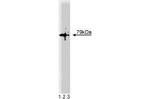 Western blot analysis of PKCtheta on a Jurkat lysate. (PKC theta Antikörper  (AA 21-217))