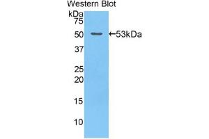Western blot analysis of recombinant Mouse GZMB. (GZMB Antikörper  (AA 16-244))