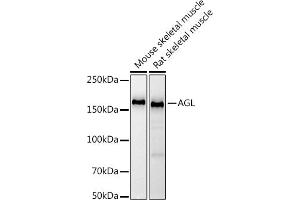 Western blot analysis of extracts of various cell lines, using (ABIN7265574) at 1:1000 dilution. (AGL Antikörper)