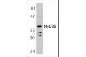 Western blot analysis of MyD88 in Jurkat whole cell lysate with this product at 1 μg/ml. (MYD88 Antikörper  (AA 233-248))