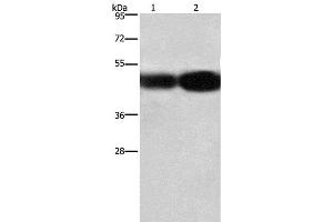 Western Blot analysis of A549 and 231 cell using BSG Polyclonal Antibody at dilution of 1:430 (CD147 Antikörper)