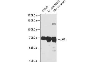 Western blot analysis of extracts of various cell lines, using p63 antibody (ABIN6133472, ABIN6149425, ABIN6149428 and ABIN6216786) at 1:3000 dilution. (p63 Antikörper  (AA 1-160))