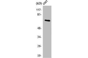 Western Blot analysis of 293 cells using POT1 Polyclonal Antibody (POT1 Antikörper  (Internal Region))