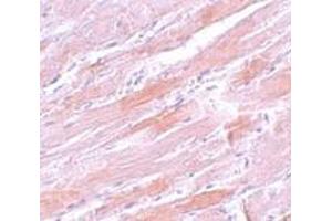 Immunohistochemistry (IHC) image for anti-Isocitrate Dehydrogenase 2 (NADP+), Mitochondrial (IDH2) (N-Term) antibody (ABIN1031407) (IDH2 Antikörper  (N-Term))