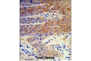 Formalin-fixed and paraffin-embedded human skin reacted with ATP12A Antibody (Center), which was peroxidase-conjugated to the secondary antibody, followed by DAB staining. (ATP12A Antikörper  (AA 833-859))