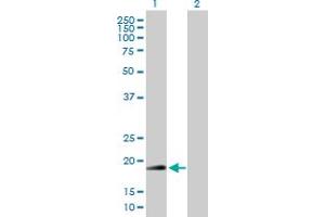 Western Blot analysis of RNF185 expression in transfected 293T cell line by RNF185 MaxPab polyclonal antibody. (RNF185 Antikörper  (AA 1-192))