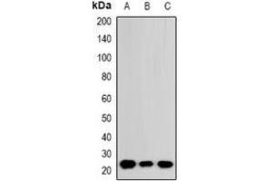 Western blot analysis of RhoGDI alpha expression in A549 (A), DLD (B), HepG2 (C) whole cell lysates. (ARHGDIA Antikörper  (C-Term))
