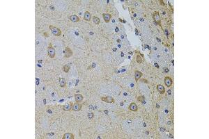 Immunohistochemistry of paraffin-embedded mouse brain using GM13125 antibody (ABIN6127294, ABIN6141172, ABIN6141175 and ABIN6216319) at dilution of 1:100 (40x lens). (Pramel15 Antikörper  (AA 1-477))