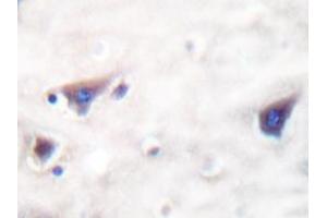 Immunohistochemistry analyzes of KSR antibody in paraffin-embedded human brain tissue. (KSR1 Antikörper)