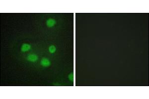 Immunofluorescence analysis of HepG2 cells, using SIX6 antibody. (SIX Homeobox 6 Antikörper)