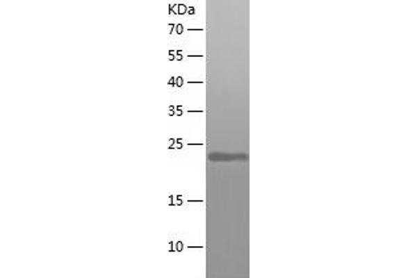 ARF6 Protein (AA 1-175) (His tag)