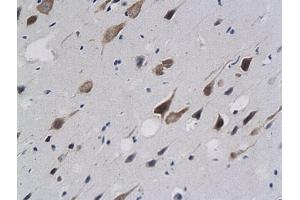 Formalin-fixed and paraffin embedded rat brain labeled with anti-Calponin 1/COLP Polyclonal Antibody (ABIN724820), Unconjugated followed by conjugation to the secondary antibody and DAB staining (CNN1 Antikörper  (AA 201-297))