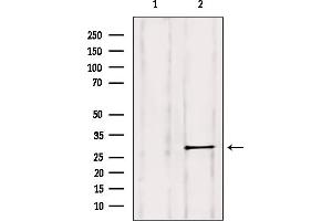 Western blot analysis of extracts from HepG2, using Rab 11B Antibody. (RAB11B Antikörper  (C-Term))