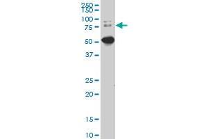 DCP1A monoclonal antibody (M02), clone 2F11. (DCP1A Antikörper  (AA 186-285))