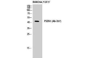 Western Blotting (WB) image for anti-Presenilin 1 (PSEN1) (Ser45), (Thr41) antibody (ABIN3186557)