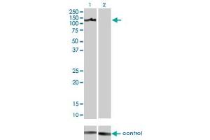 Western blot analysis of AXL over-expressed 293 cell line, cotransfected with AXL Validated Chimera RNAi (Lane 2) or non-transfected control (Lane 1). (AXL Antikörper  (AA 30-140))