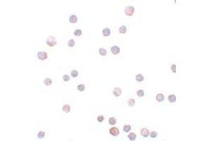Immunohistochemistry (IHC) image for anti-Zinc Finger E-Box Binding Homeobox 1 (ZEB1) (Middle Region) antibody (ABIN1031173) (ZEB1 Antikörper  (Middle Region))