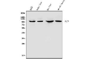 Western blot analysis of MTTP using anti-MTTP antibody (ABIN7601145).