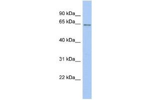 WB Suggested Anti-SMARCD2 Antibody Titration: 0. (SMARCD2 Antikörper  (Middle Region))