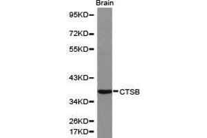 Western Blotting (WB) image for anti-Cathepsin B (CTSB) antibody (ABIN1872095) (Cathepsin B Antikörper)