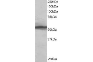 Western Blotting (WB) image for anti-Karyopherin alpha 2 (RAG Cohort 1, Importin alpha 1) (KPNA2) (C-Term) antibody (ABIN185157)