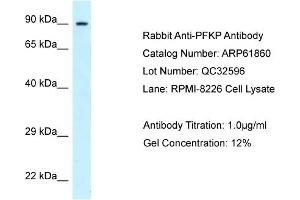 Western Blotting (WB) image for anti-phosphofructokinase, Platelet (PFKP) (C-Term) antibody (ABIN2788927)