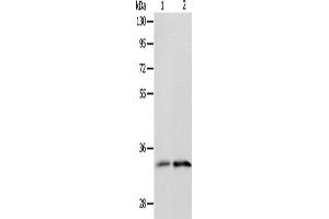 Western Blotting (WB) image for anti-Interleukin 1 Receptor-Like 1 (IL1RL1) antibody (ABIN2428923) (IL1RL1 Antikörper)