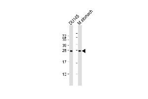 Lane 1: DU145 Cell lysates, Lane 2: mouse stomach Cell lysates, probed with RAB27B (1596CT245. (RAB27B Antikörper)