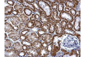 Immunohistochemistry (IHC) image for anti-Thiosulfate Sulfurtransferase (Rhodanese) (TST) antibody (ABIN2856290)