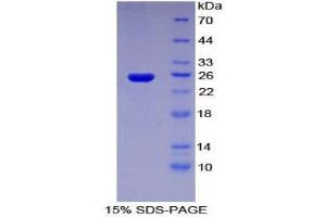 SDS-PAGE (SDS) image for Sprouty Homolog 3 (SPRY3) (AA 91-288) protein (His tag) (ABIN1878343)