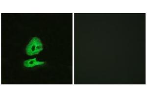Immunofluorescence analysis of HeLa cells, using GLR antibody.