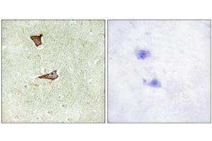 Immunohistochemistry (IHC) image for anti-Insulin-Like Growth Factor 2 Receptor (IGF2R) (pSer2409) antibody (ABIN1847437) (IGF2R Antikörper  (pSer2409))