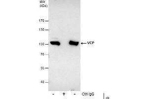 Immunoprecipitation (IP) image for anti-Valosin Containing Protein (VCP) (C-Term) antibody (ABIN2854929)