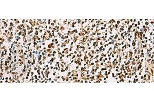 Immunohistochemistry of paraffin-embedded Human tonsil tissue using FOXI1 Polyclonal Antibody at dilution of 1:55(x200) (FOXI1 Antikörper)