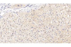 Detection of CD73 in Human Liver Tissue using Polyclonal Antibody to Cluster Of Differentiation 73 (CD73) (CD73 Antikörper  (AA 29-500))