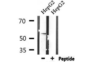 Western blot analysis of extracts from HepG2, using STK38L Antibody.
