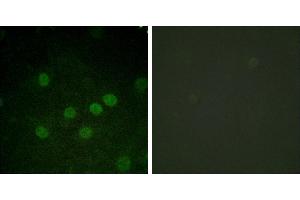 serum + -Immunofluorescence analysis of HuvEc cells, treated with serum (20%, 30mins), using Histone H1 (Phospho-Thr17) antibody. (Histone H1 Antikörper  (pThr17))
