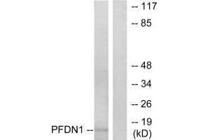 Western blot analysis of extracts from RAW264. (PFDN1 Antikörper)