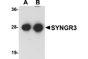 Western Blotting (WB) image for anti-Synaptogyrin 3 (SYNGR3) (C-Term) antibody (ABIN1030716)