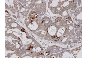 Immunohistochemistry (IHC) image for anti-E74-Like Factor 3 (Ets Domain Transcription Factor, Epithelial-Specific) (ELF3) (C-Term) antibody (ABIN2854672)