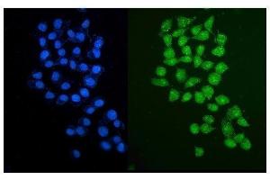 IF analysis of PARP2 using anti-PARP2 antibody (ABIN7599929).