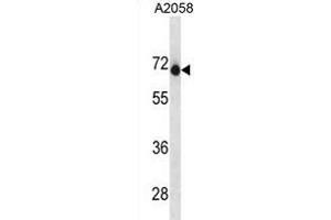 ENDOD1 Antibody (Center) (ABIN1881294 and ABIN2838756) western blot analysis in  cell line lysates (35 μg/lane). (ENDOD1 Antikörper  (AA 255-284))