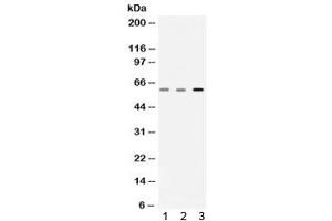 Western blot testing of 1) rat skeletal muscle, 2) mouse skeletal muscle and 3) human A549 lysate with Catalase antibody. (Catalase Antikörper)