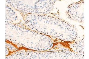 ABIN6267072 at 1/100 staining mouse testis tissue sections by IHC-P. (JAK1 Antikörper  (pTyr1022, pTyr1023))