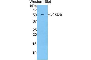 Western Blotting (WB) image for anti-Protease, serine, 8 (PRSS8) (AA 124-342) antibody (ABIN1860330)