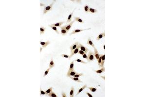 Immunohistochemistry (IHC) image for anti-X-Ray Repair Complementing Defective Repair in Chinese Hamster Cells 5 (Double-Strand-Break Rejoining) (XRCC5) (AA 648-662), (C-Term) antibody (ABIN3044235)