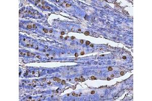 IHC analysis of TFF3 using anti-TFF3 antibody (ABIN5692886).